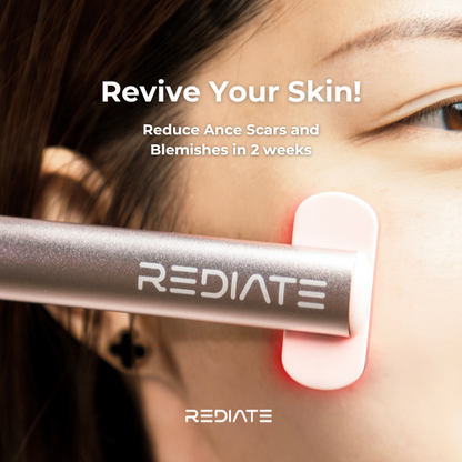 Revive Wand: Target Wrinkles, Acne Scars & Blemishes with Red Light Therapy